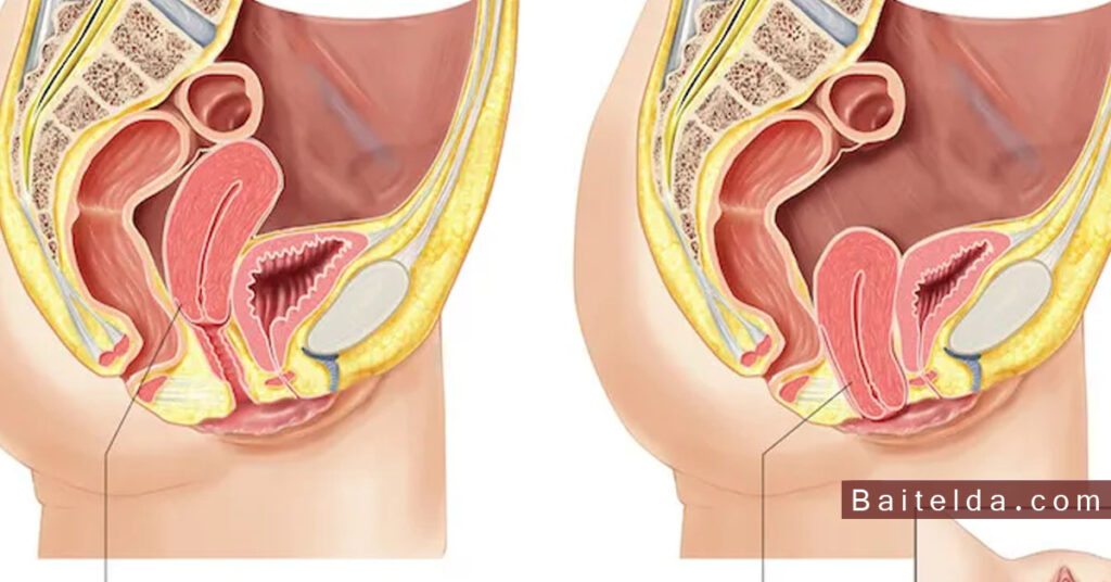 ما هي أعراض نزول الرحم بعد الولادة ؟